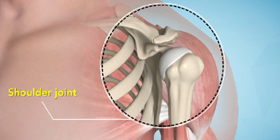 Shoulder joint treatment in Bhuj Kutch