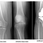 Knee - Human Anatomy